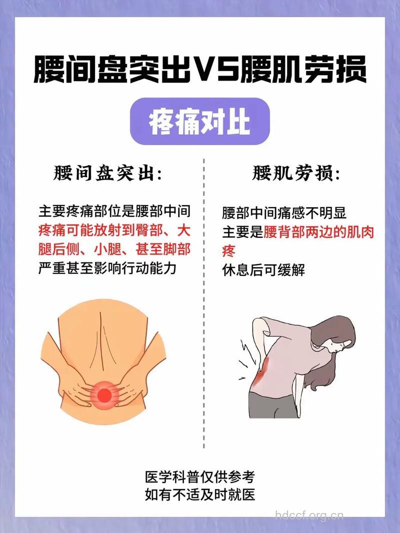 如何鉴别腰椎间盘突出和腰肌劳损？