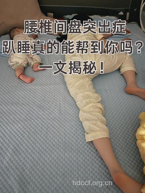 趴着午睡小心成腰椎间盘突出