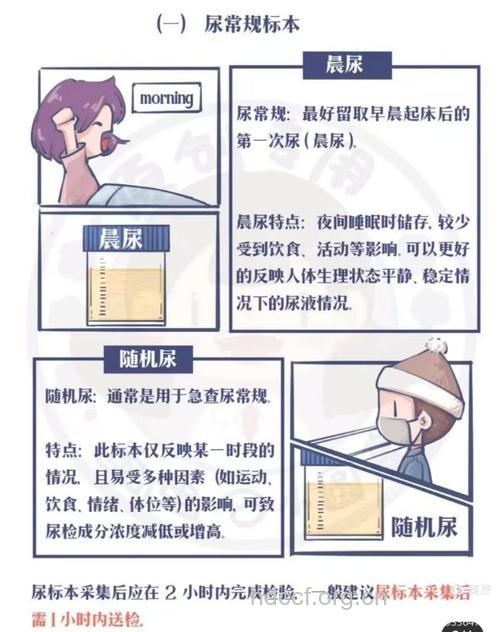 糖尿病性肾病患者怎样留尿样？