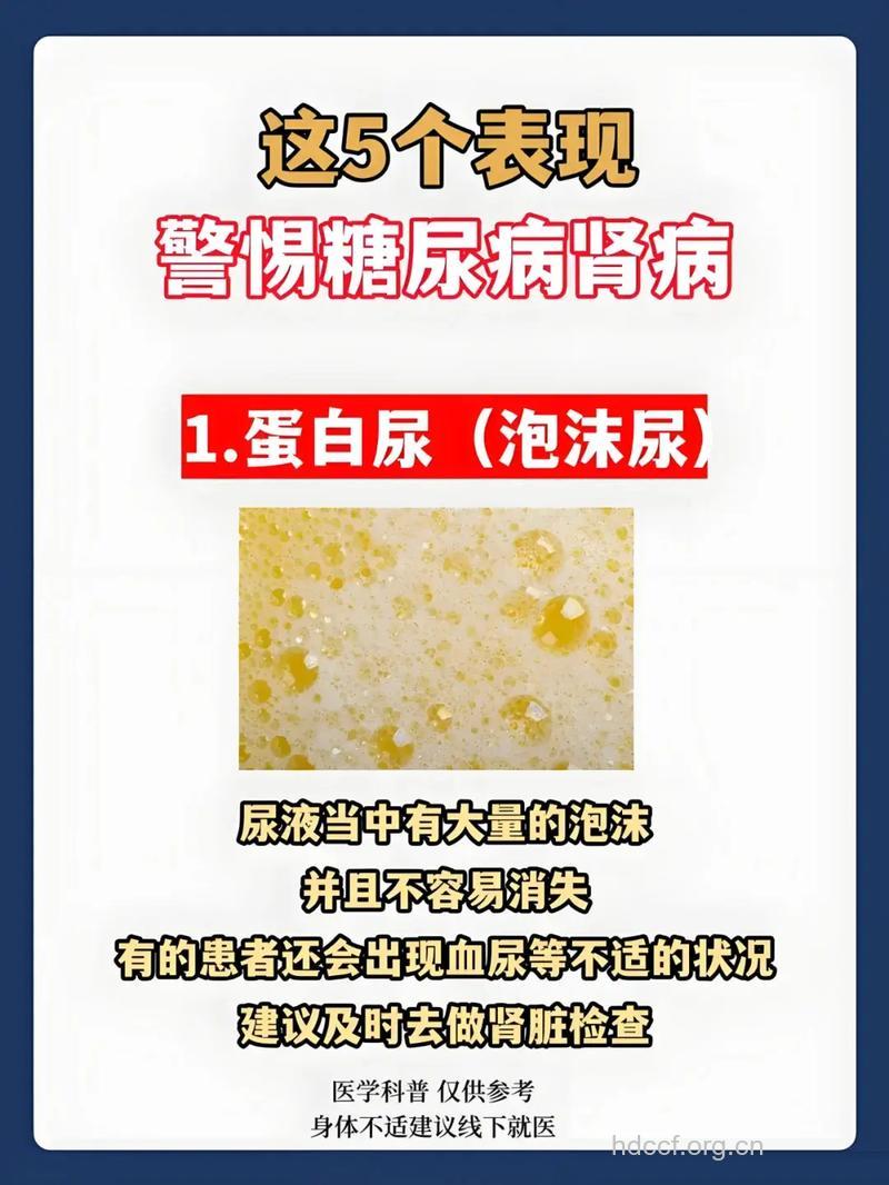 糖尿病肾病的喜讯