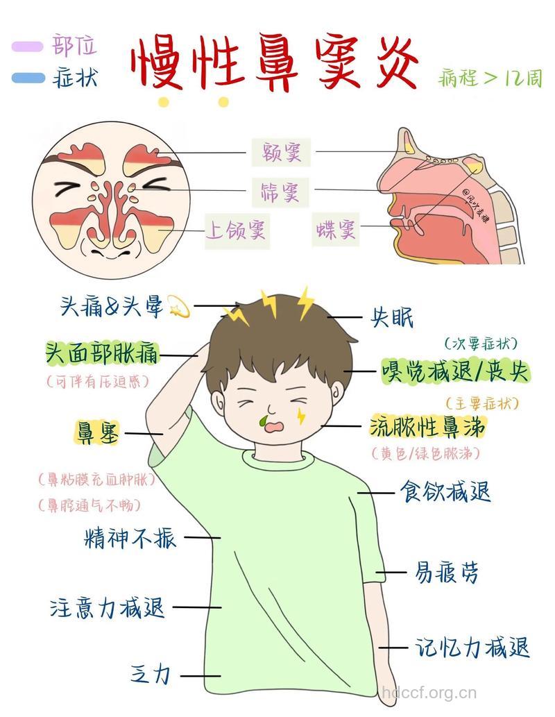 慢性鼻窦炎的几种常见症状