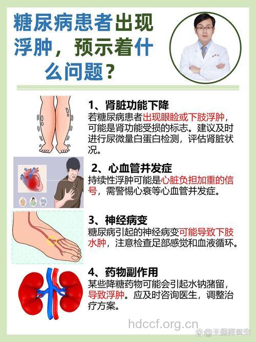 糖肾患者：你的浮肿从哪开始