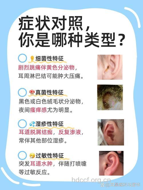 什么是弥漫性外耳道炎 发病原因有哪些