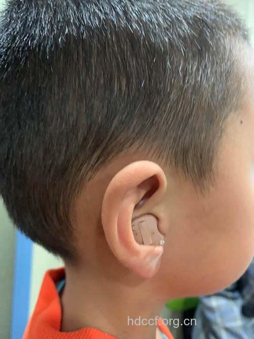 儿童助听器耳膜一般多久换一次