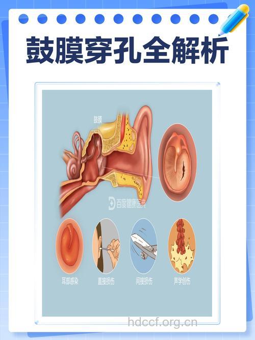 鼓膜穿孔产生的原因有哪些 该如何治疗?