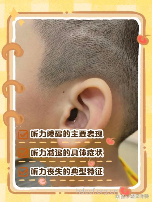 孩子说话晚与耳朵有关 听力障碍宝宝的表现