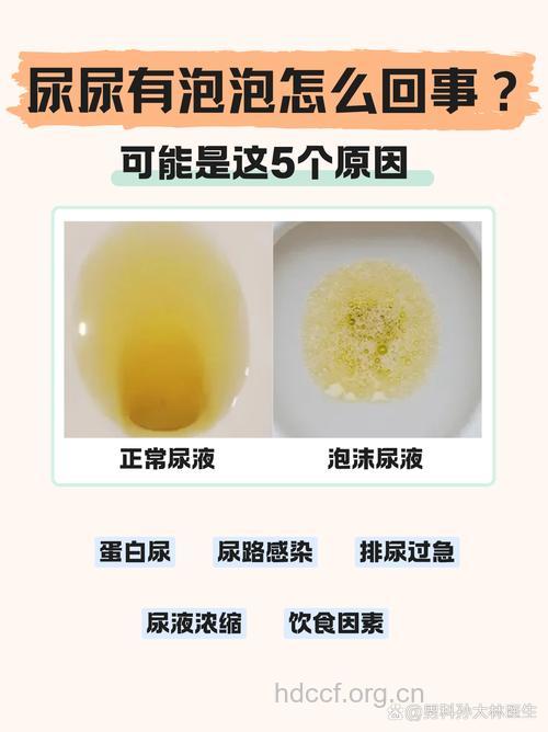 尿里的泡泡多是什么原因?