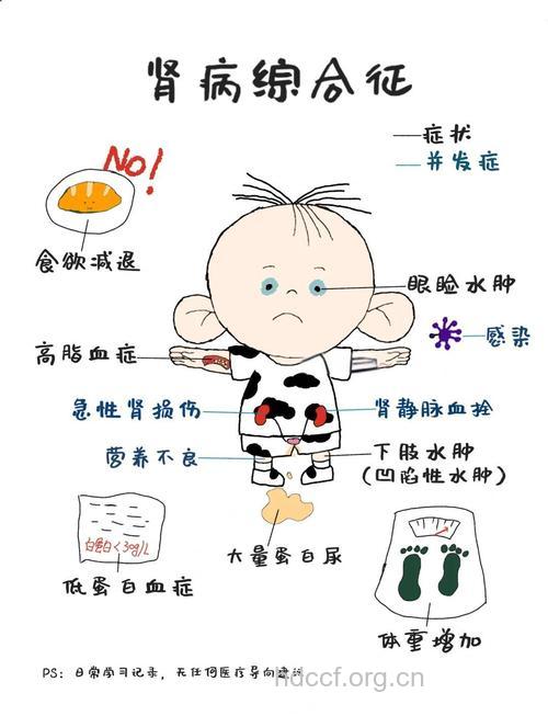 儿童肾病有哪些表现症状