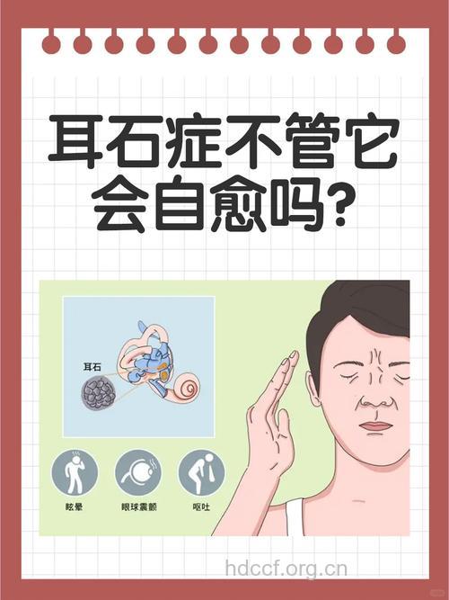耳石症发病的三个特殊性要当心