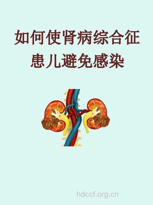 如何预防小儿肾病综合征