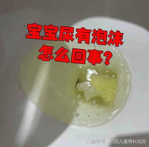 小儿急性肾炎尿异常症状