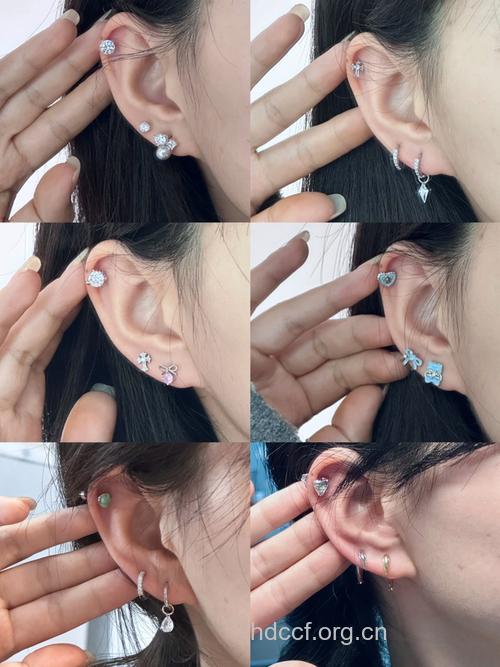 耳环太重耳垂变两半 打耳洞要慎重