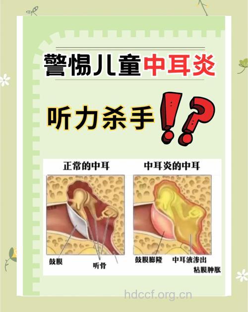 小儿中耳炎简介