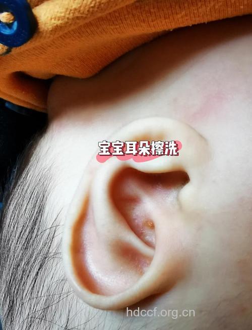 怎样正确清洗宝宝的耳朵