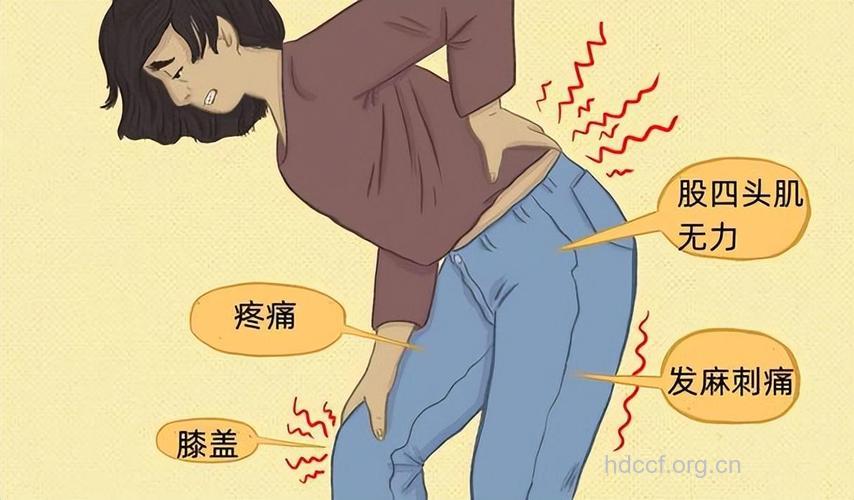 哪些人易腰腿痛