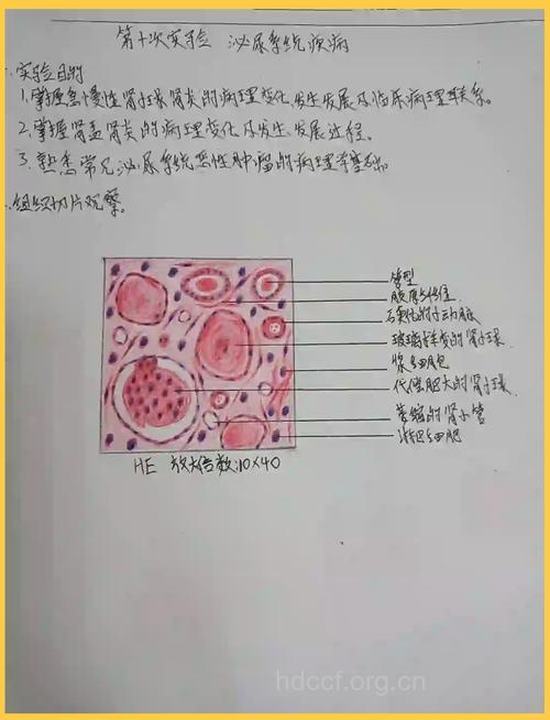 小儿慢性肾小球肾炎的诊断