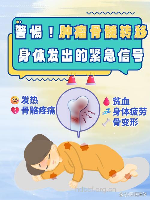 腰腿痛须慎防恶性肿瘤