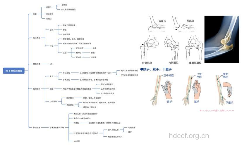 肘关节脱位的分型及检查方法