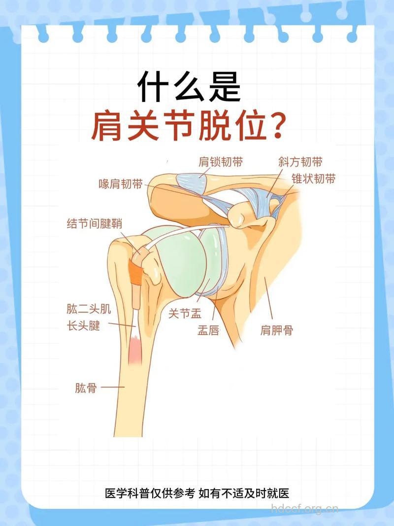 先天性肩关节脱位几个常识