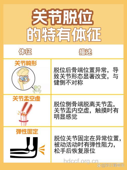 介绍几个关节脱位的合关症