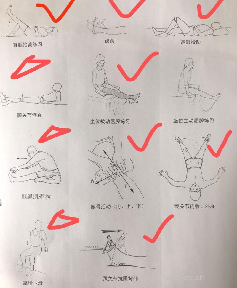 关节脱位治疗的各种方法