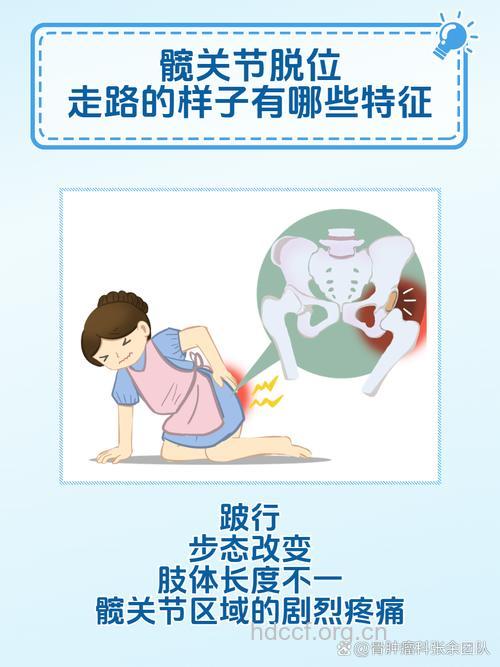 先天性髋关节脱位常见哪些并发症