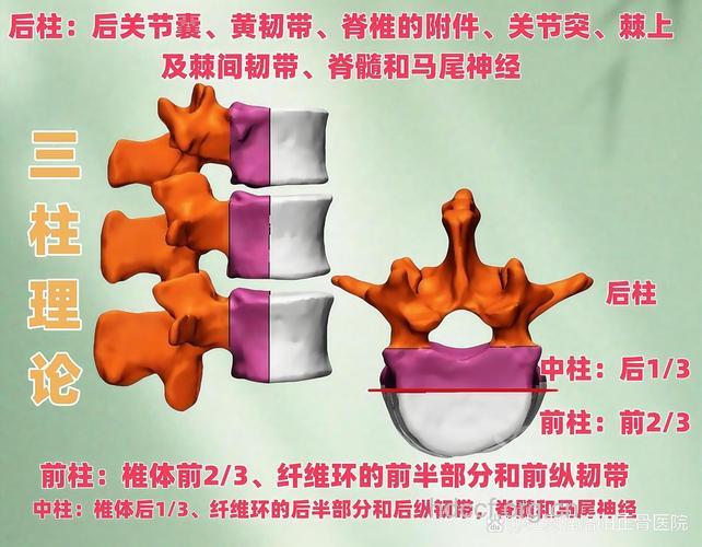 专家全面解析颈椎骨折脱位