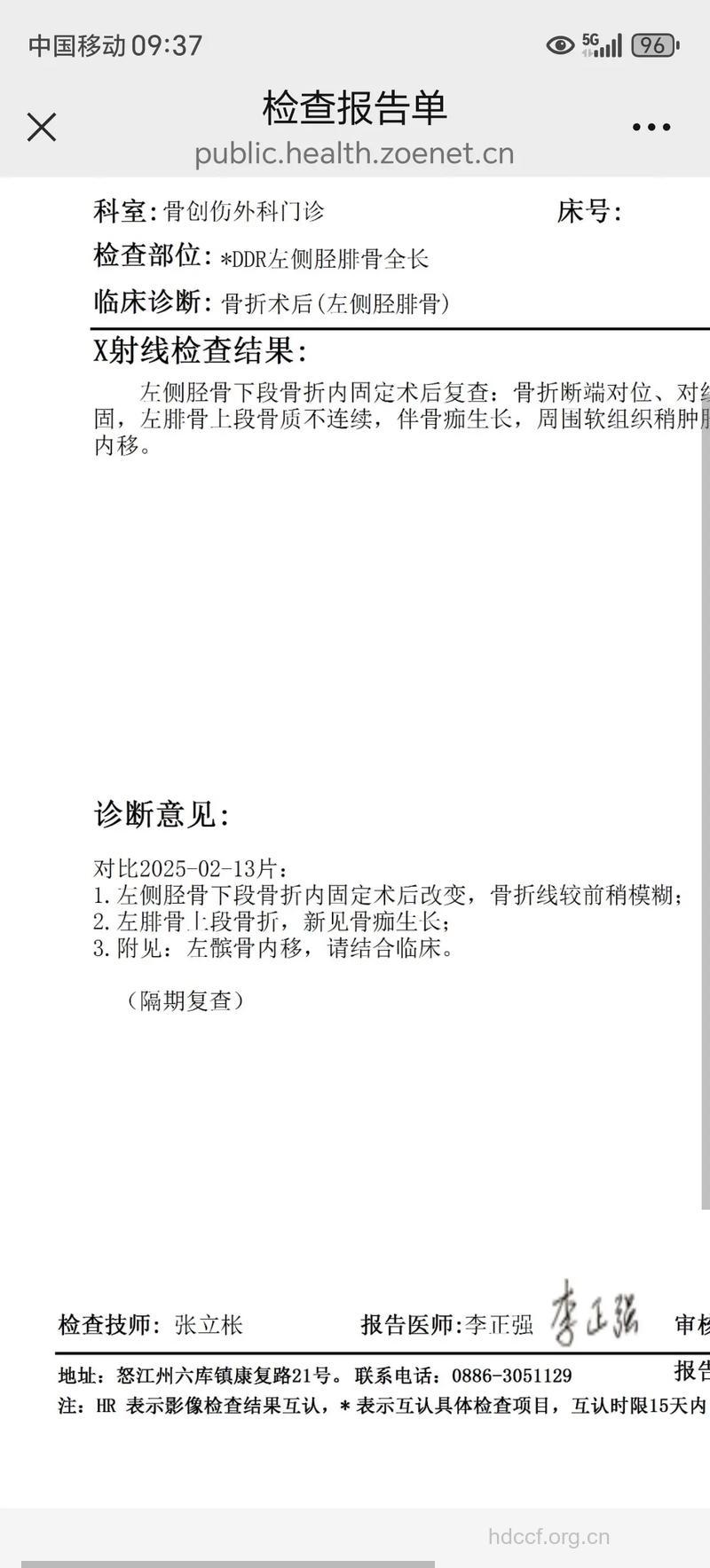 右髋关节后脱位病例解析