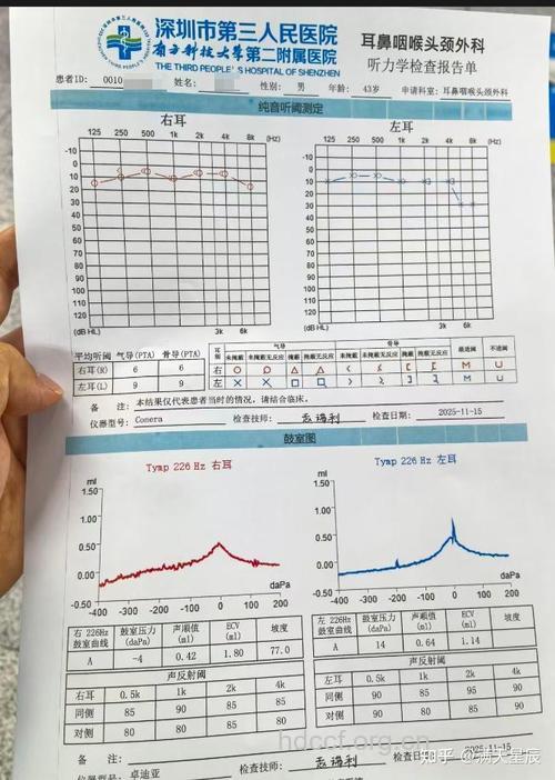 耳鸣有哪些检查项目呢