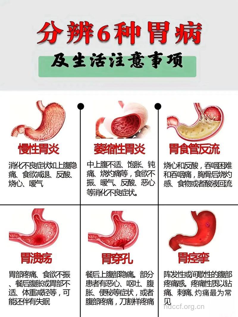 如何对急性胃炎进行辨证施治