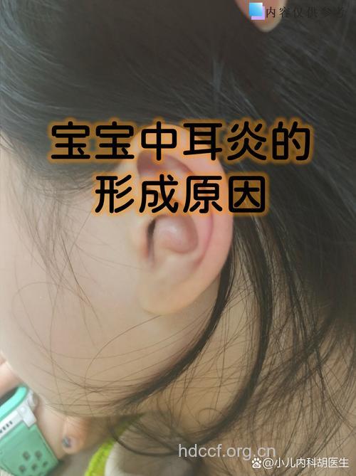 幼儿中耳炎有什么症状