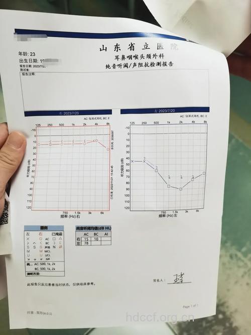 如何诊断突发性耳聋