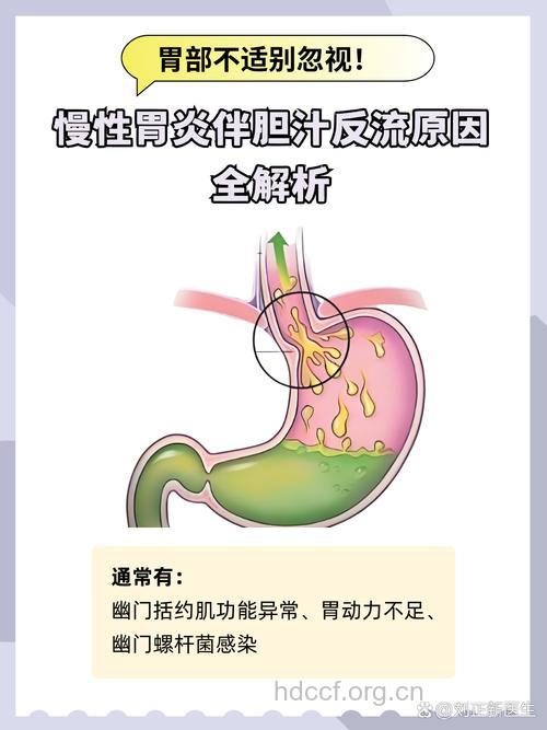 导致慢性胃炎的原因有哪些