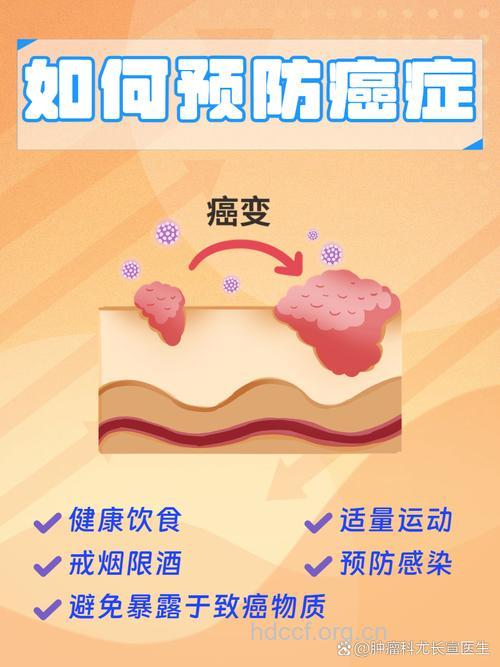 三成癌症通过改变生活方式可避免