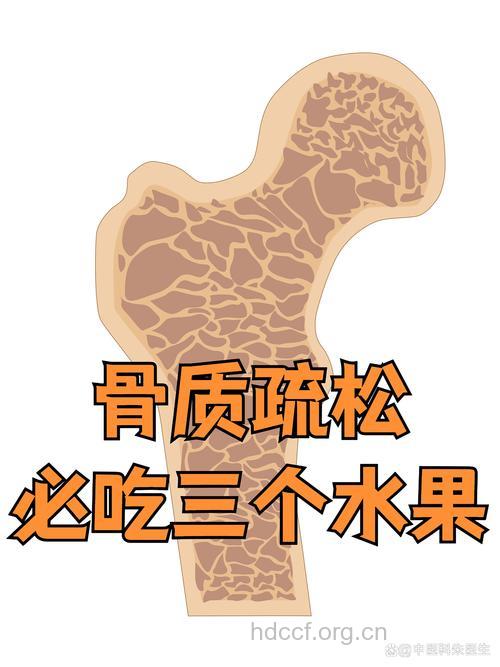 容易导致骨质疏松的食物是什么