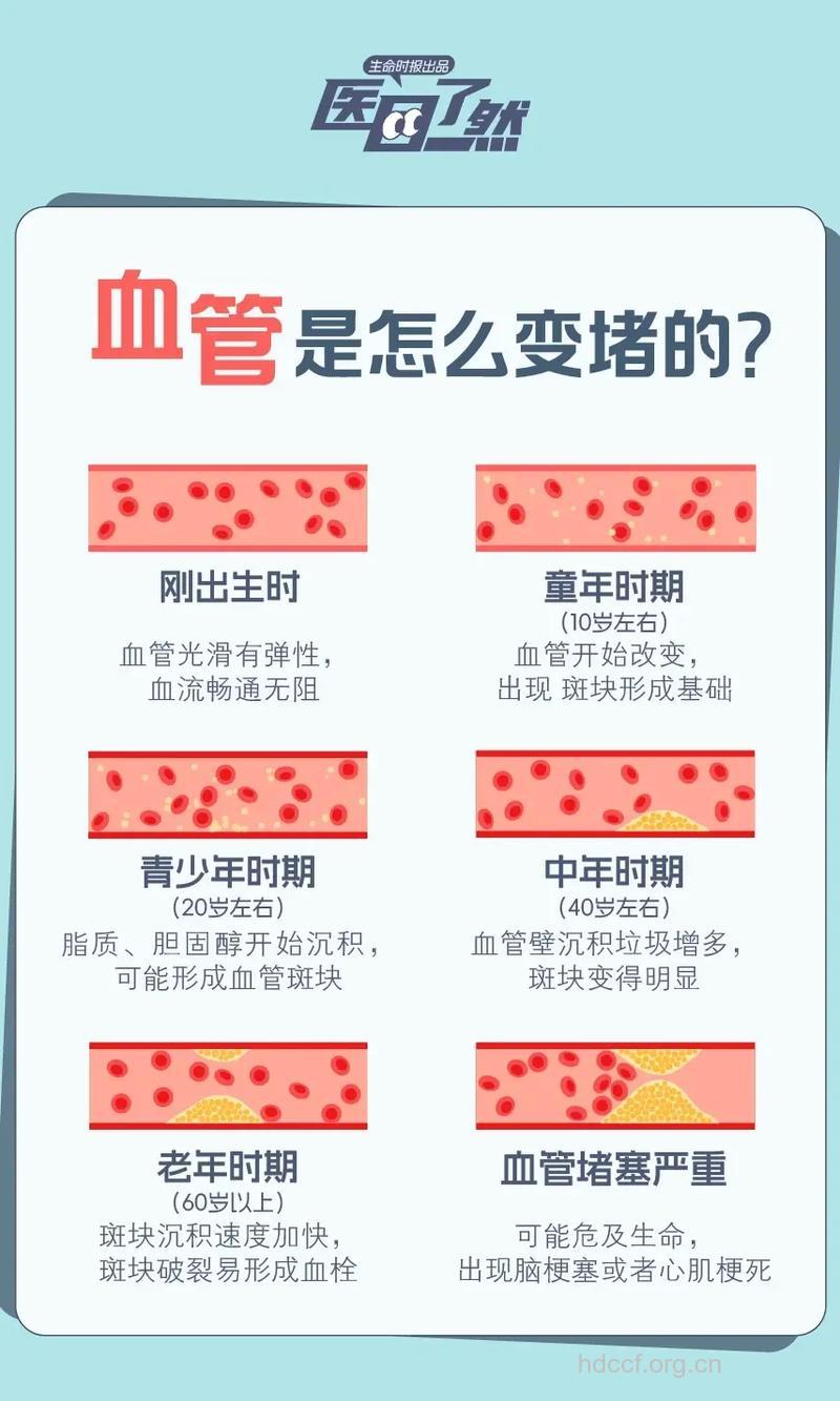 老年人血管病变会引起耳聋吗