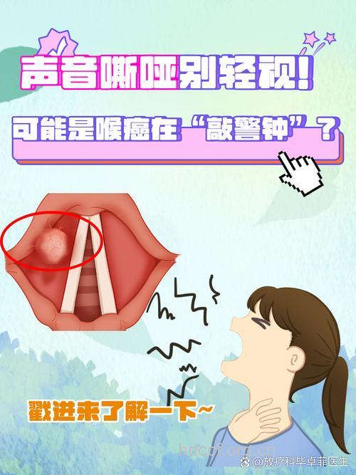 嗓子突然嘶哑竟然与肿瘤有关