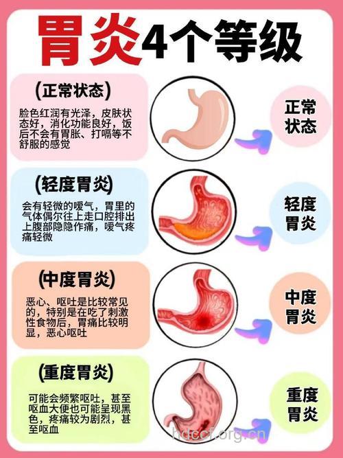 哪些原因会导致慢性胃炎
