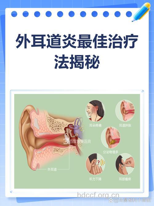 关于外耳道炎有哪些治疗方法