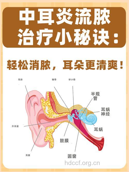 化脓性中耳炎有哪些防治方法