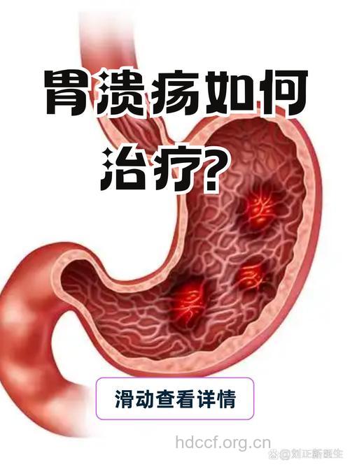 慢性胃炎复发也很突然