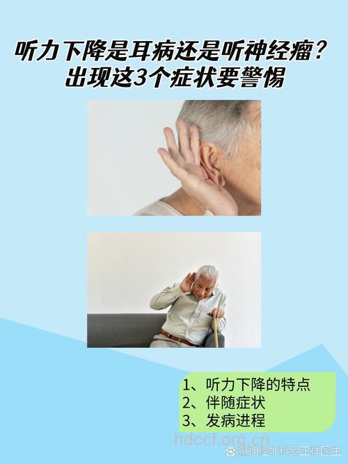 老人听力渐退小心神经瘤