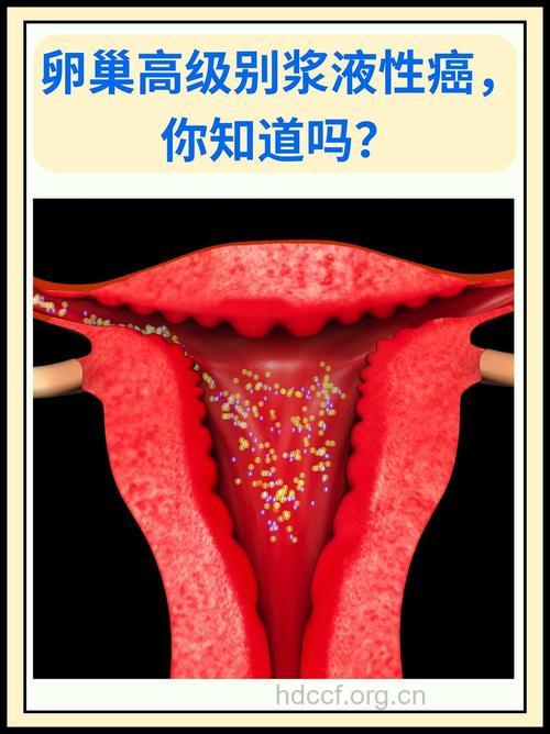 女性私处都有哪些癌症