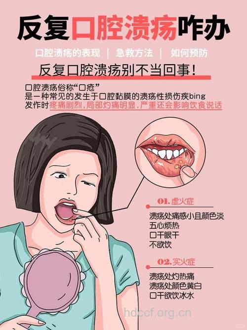 口腔溃疡很久了要怎么办