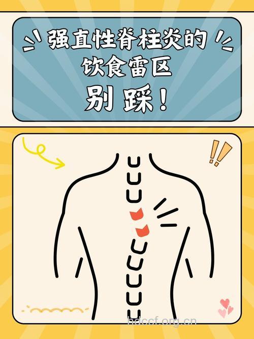 强直性脊柱炎患者如何进行食疗