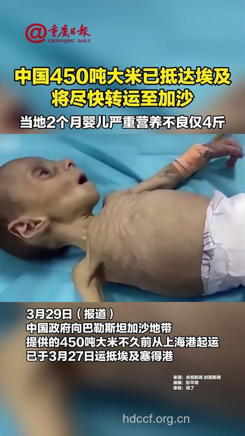 儿童营养失衡易患癌