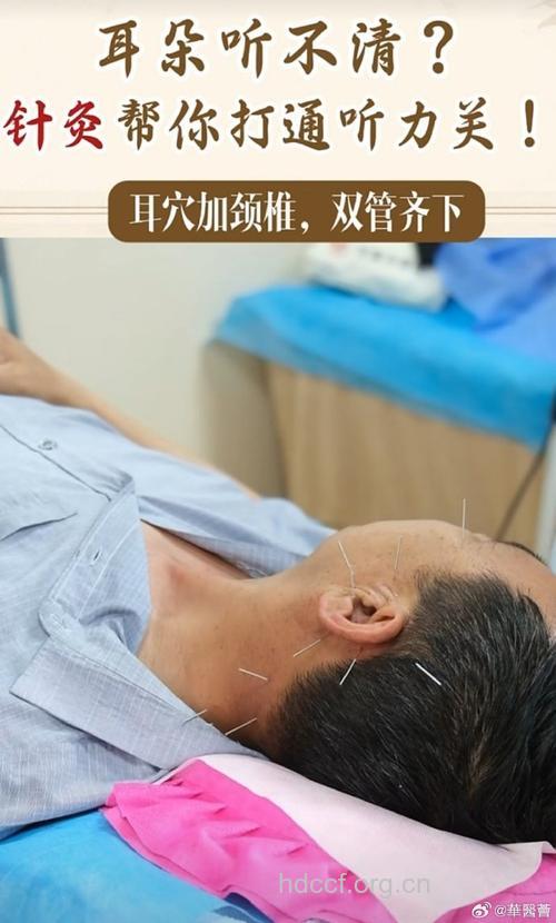 针灸有效治疗老年人耳鸣