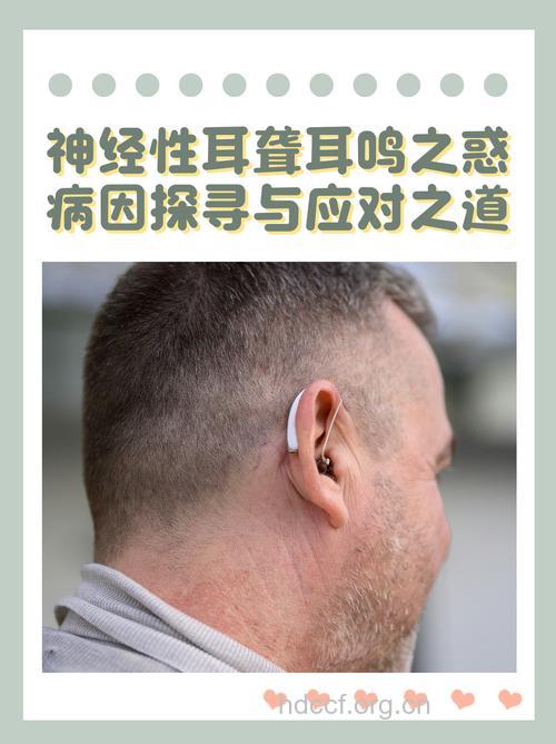 你关注神经性耳聋吗了?