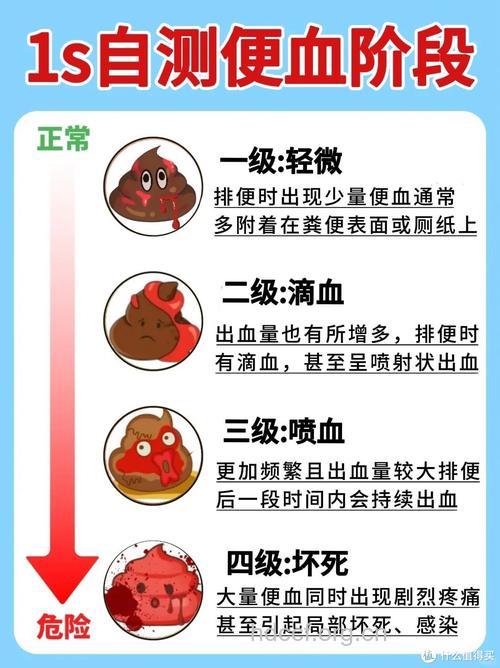 便血时要注意区分是痔疮还是肿瘤