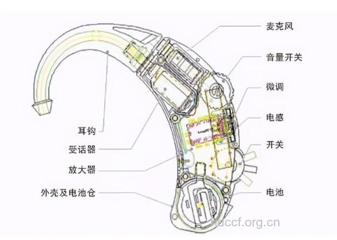 助听器个基本结构